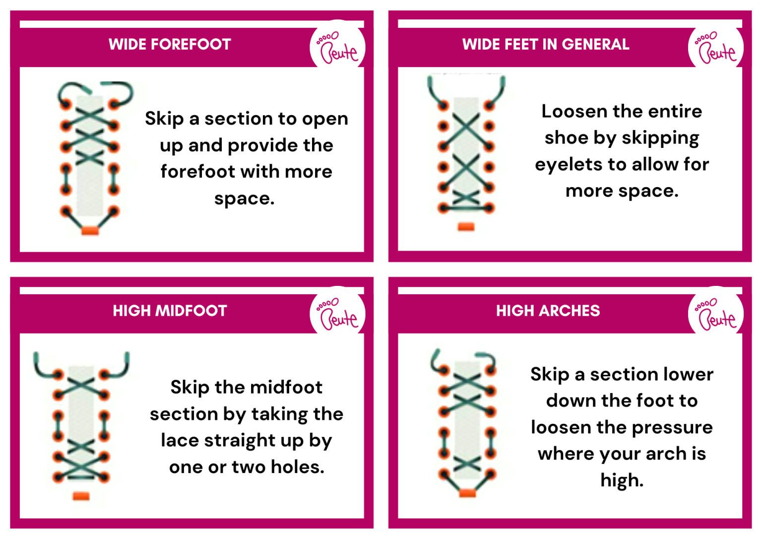Mastering Shoe Lace Techniques: A Guide for Happy Feet – The Beute Clinic